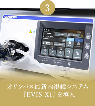 オリンパス最新内視鏡システム『EVIS X1』を導入