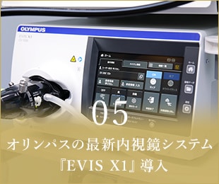 05オリンパスの最新内視鏡システム『EVIS X1』導入