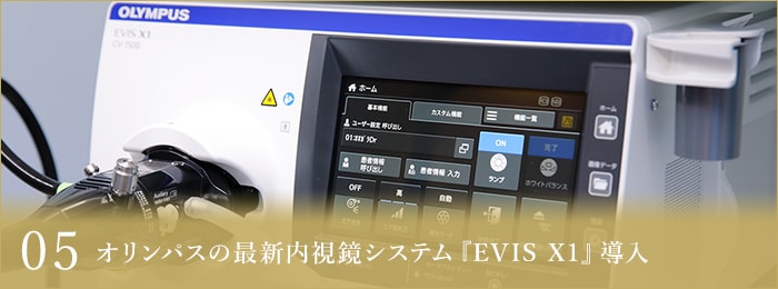 05オリンパスの最新内視鏡システム『EVIS X1』導入