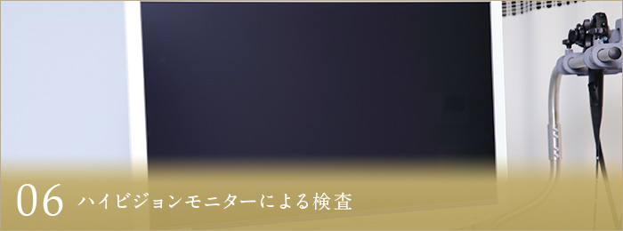 06 ハイビジョンモニターによる検査